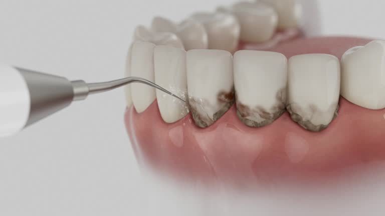Reliable Dental contractor in Keizer, OR by Smile Center Dentistry